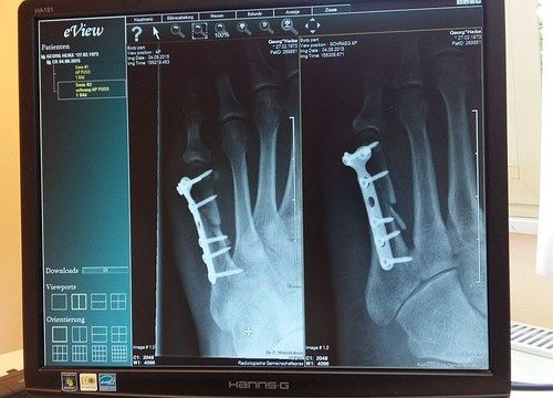 Horario Cita Traumatología y Ortopedia